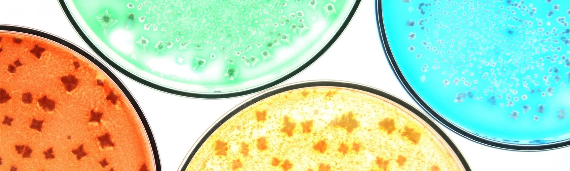 Probiotics: Origins and Actions